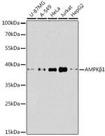 AMPK beta-1 Antibody in Western Blot (WB)