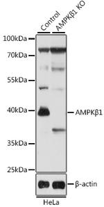 AMPK beta-1 Antibody in Western Blot (WB)