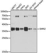 SMN2 Antibody in Western Blot (WB)