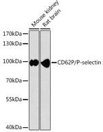 P-Selectin (CD62P) Antibody in Western Blot (WB)