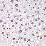 TOP1 Polyclonal Antibody