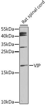 VIP Antibody in Western Blot (WB)