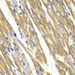 Tyrosinase Polyclonal Antibody