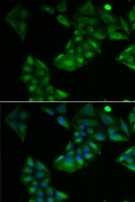Thioredoxin 2 Antibody in Immunocytochemistry (ICC/IF)
