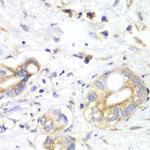 Thioredoxin 2 Antibody in Immunohistochemistry (Paraffin) (IHC (P))