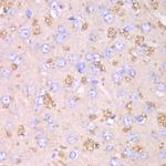 Thioredoxin 2 Antibody in Immunohistochemistry (Paraffin) (IHC (P))