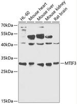 MTIF3 Polyclonal Antibody