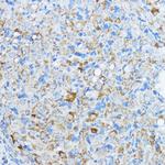 Aromatase Antibody in Immunohistochemistry (Paraffin) (IHC (P))