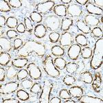 VEGFB Antibody in Immunohistochemistry (Paraffin) (IHC (P))