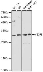 VEGFB Antibody in Western Blot (WB)