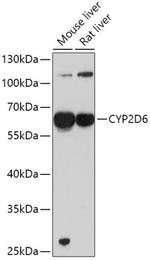 CYP2D6 Polyclonal Antibody
