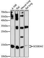UGRP1 Antibody in Western Blot (WB)