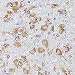 CKAP1 Antibody in Immunohistochemistry (Paraffin) (IHC (P))