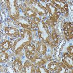 CKAP1 Antibody in Immunohistochemistry (Paraffin) (IHC (P))