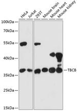 CKAP1 Antibody in Western Blot (WB)