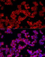 ALDH3A1 Antibody in Immunocytochemistry (ICC/IF)