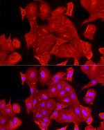 ALDH3A1 Antibody in Immunocytochemistry (ICC/IF)