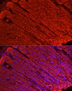 ALDH3A1 Antibody in Immunocytochemistry (ICC/IF)