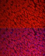 ALDH3A1 Antibody in Immunocytochemistry (ICC/IF)