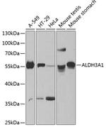 ALDH3A1 Antibody in Western Blot (WB)
