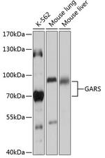 GARS Polyclonal Antibody