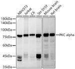 PKC alpha Antibody in Western Blot (WB)