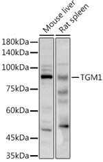 TGM1 Polyclonal Antibody
