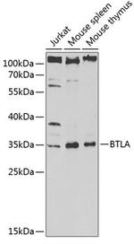 BTLA Polyclonal Antibody