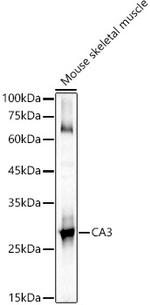 Carbonic Anhydrase III Antibody in Western Blot (WB)