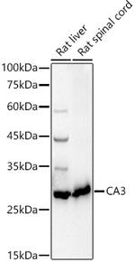 Carbonic Anhydrase III Antibody in Western Blot (WB)
