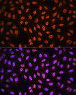 MCM5 Polyclonal Antibody