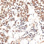 MCM5 Antibody in Immunohistochemistry (Paraffin) (IHC (P))