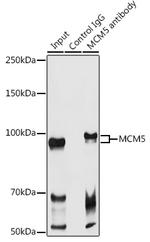 MCM5 Antibody in Immunoprecipitation (IP)