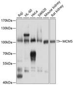 MCM5 Antibody in Western Blot (WB)