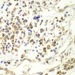 UPF1 Polyclonal Antibody