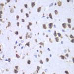 UPF1 Antibody in Immunohistochemistry (Paraffin) (IHC (P))