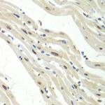 UPF1 Antibody in Immunohistochemistry (Paraffin) (IHC (P))