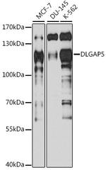 DLG7 Antibody in Western Blot (WB)
