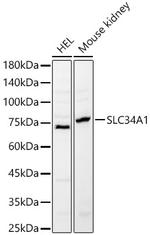 SLC34A1 Polyclonal Antibody