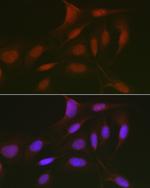 p130 Polyclonal Antibody