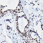 HDGF Antibody in Immunohistochemistry (Paraffin) (IHC (P))
