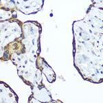 RhoA Polyclonal Antibody
