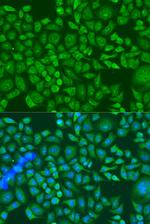 IGF2BP2 Antibody in Immunocytochemistry (ICC/IF)