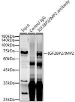 IGF2BP2 Antibody in Immunoprecipitation (IP)