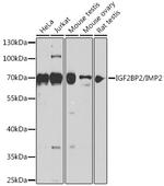 IGF2BP2 Antibody in Western Blot (WB)