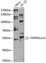TMPRSS11A Antibody in Western Blot (WB)