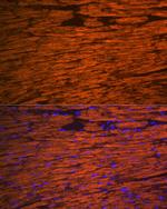 MYL2 Antibody in Immunohistochemistry (Paraffin) (IHC (P))