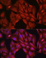 VASP Polyclonal Antibody