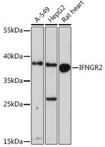 IFNGR2 Polyclonal Antibody
