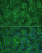 CBS Polyclonal Antibody